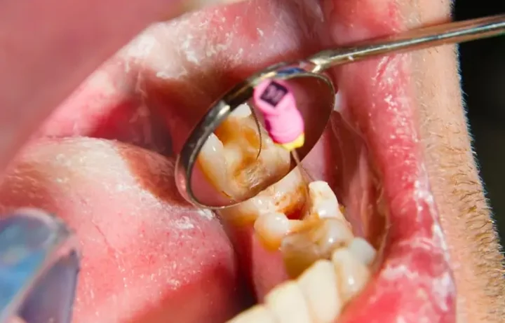 Empastes dentales