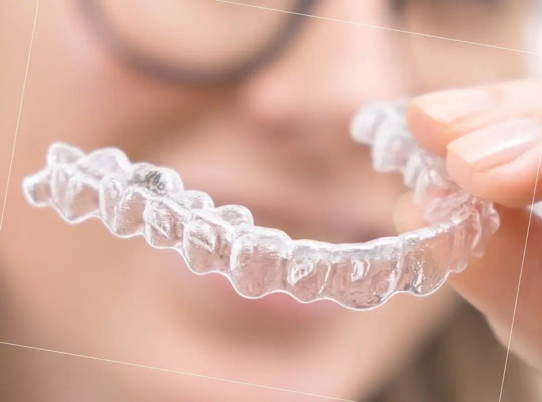 Como funciona el tratamiento invisalign