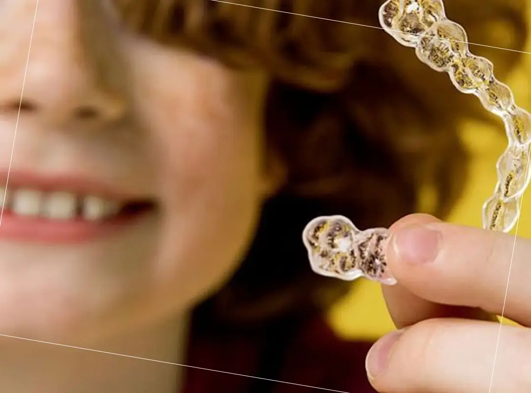 que es el sistema invisalign