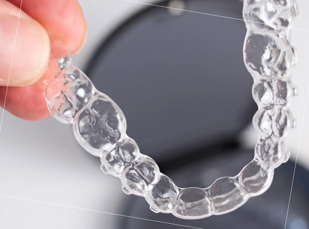 Ventajas del sistema invisalign