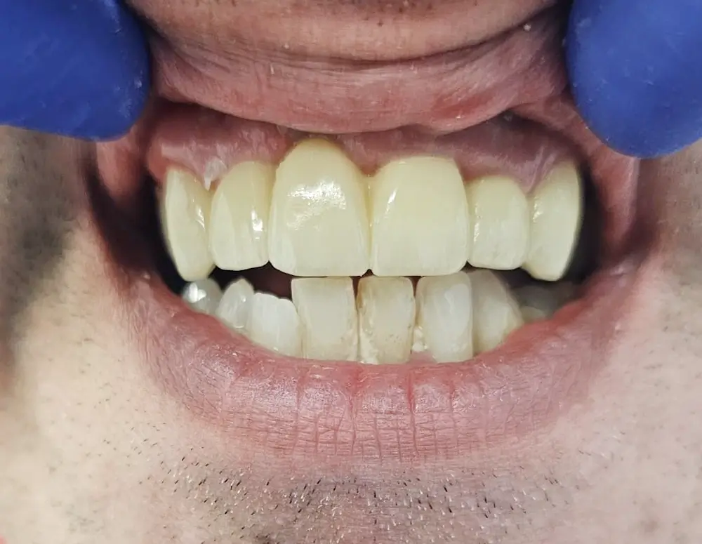Paciente después de tratamiento clínica dental Qident